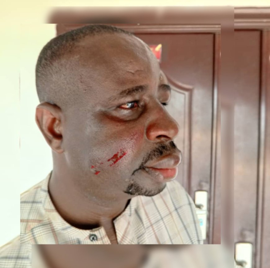 EXCLUSIVE: Ahoada East LG Sole Administrator Beaten Blue and Black, Forced To Resign By Stakeholders
