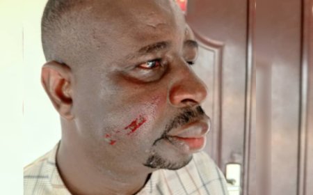 EXCLUSIVE:  Ahoada East LG Sole Administrator Beaten Blue and Black, Forced To Resign By Stakeholders