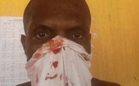 Efut Youth Council Petitions Cross River Governor Over CTRA Alleged Brutalisation of Transport Driver in Calabar