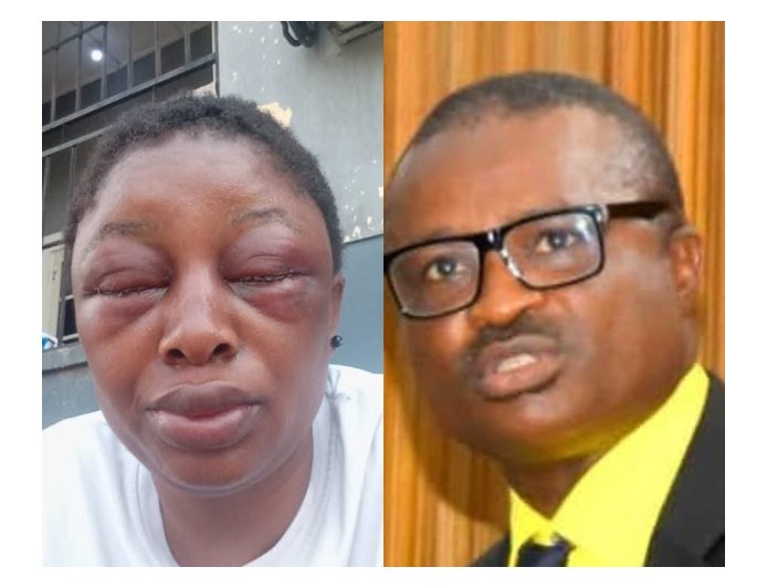 C'River Assembly Suspends Lawmaker Over Domestic Violence Allegations