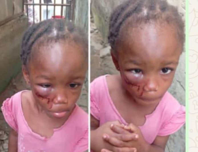 Calabar Pastor’s Wife Arrested Over Alleged Abuse of 5-Year-Old Niece