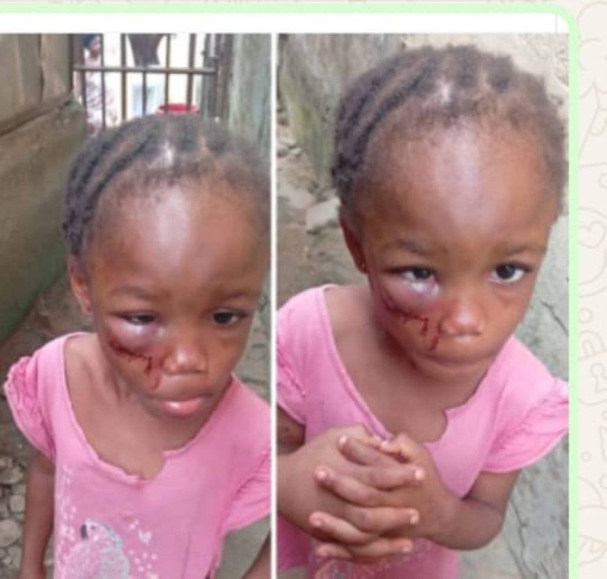 Calabar Pastor’s Wife Arrested Over Alleged Abuse of 5-Year-Old Niece