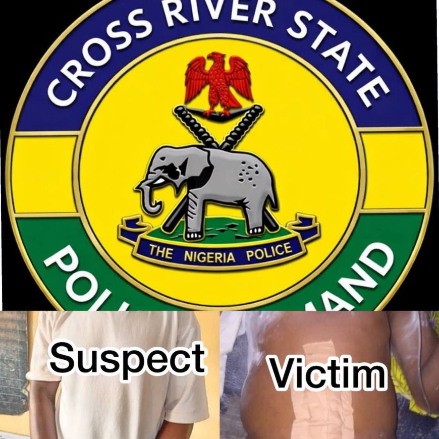 C'River Police Arrest Theatre Assistant Over Alleged Unauthorised Hernia Surgery